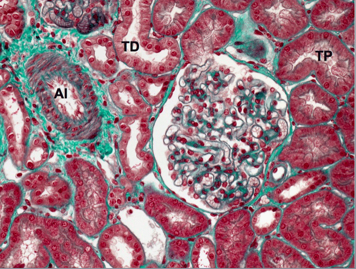 Image-2-bis.gif